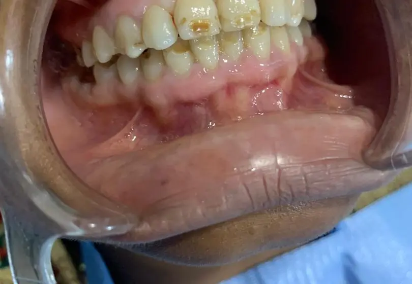 Digital Dental X-Rays care in Ota, Ogun State
